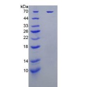 SDS-PAGE analysis of Human KIR2DL1 Protein.