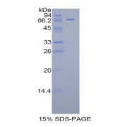 SDS-PAGE analysis of recombinant Human KIR3DL3 Protein.