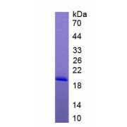 SDS-PAGE analysis of recombinant Human Kinesin Family, Member 5A (KIF5A) Protein.