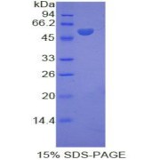 SDS-PAGE analysis of Rat KIF5A Protein.