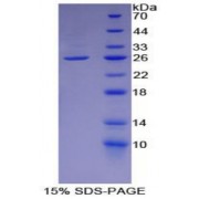 SDS-PAGE analysis of Human L1CAM Protein.