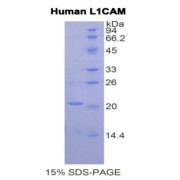 SDS-PAGE analysis of Human L1CAM Protein.