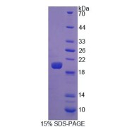 SDS-PAGE analysis of Mouse Lactoperoxidase Protein.