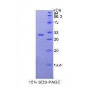 SDS-PAGE analysis of Rat Lactoperoxidase Protein.