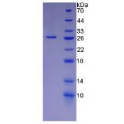 SDS-PAGE analysis of recombinant Mouse Laminin alpha 5 Protein.