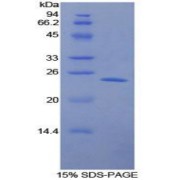 SDS-PAGE analysis of Human LMP7 Protein.