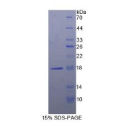 SDS-PAGE analysis of Human LCAT Protein.