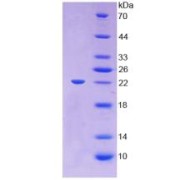 SDS-PAGE analysis of Mouse LCAT Protein.