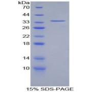 SDS-PAGE analysis of Rat LOX1 Protein.