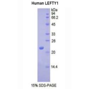 SDS-PAGE analysis of Human LEFTY1 Protein.