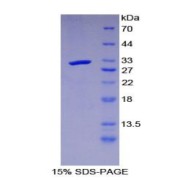 SDS-PAGE analysis of Mouse LRIG3 Protein.