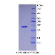 SDS-PAGE analysis of recombinant Human LIFR Protein.