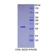 SDS-PAGE analysis of Human LIFR Protein.