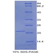 SDS-PAGE analysis of recombinant Mouse LIFR Protein.