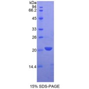 SDS-PAGE analysis of recombinant Rat LECT2 Protein.