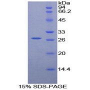 SDS-PAGE analysis of Human LILRA3 Protein.