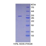 SDS-PAGE analysis of Human LIMS1 Protein.