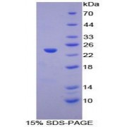 SDS-PAGE analysis of Human LAT2 Protein.
