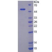 SDS-PAGE analysis of Human LBP Protein.