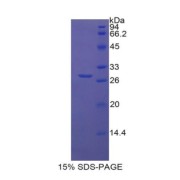 SDS-PAGE analysis of recombinant Mouse LBP Protein.