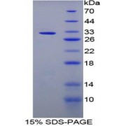 SDS-PAGE analysis of Rabbit LBP Protein.