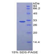 SDS-PAGE analysis of Human LRP5L Protein.
