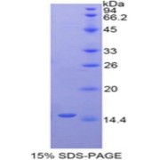 SDS-PAGE analysis of Human LYAR Protein.