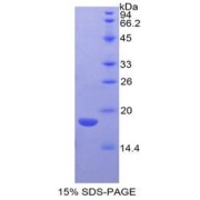 SDS-PAGE analysis of recombinant Mouse LYAR Protein.