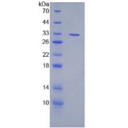 SDS-PAGE analysis of recombinant Mouse Lymphotoxin beta Protein.