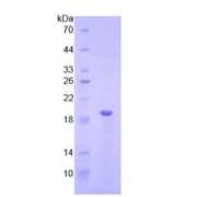 SDS-PAGE analysis of recombinant Human LPCAT3 Protein.