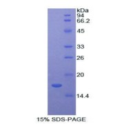 SDS-PAGE analysis of Rat Lysozyme Protein.