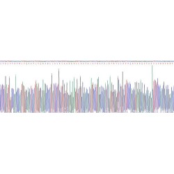 Human Lysyl Oxidase Like Protein 1 (LOXL1) Protein