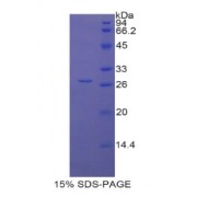 SDS-PAGE analysis of Rat LOXL1 Protein.