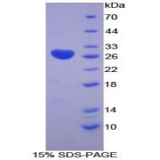 SDS-PAGE analysis of Human LOXL3 Protein.