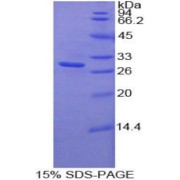 SDS-PAGE analysis of Human MST1R Protein.