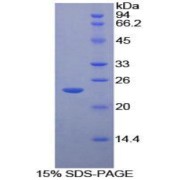 SDS-PAGE analysis of Mouse MST1R Protein.