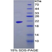 SDS-PAGE analysis of Human MGA Protein.