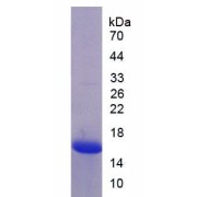 SDS-PAGE analysis of Human MASP2 Protein.