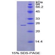 SDS-PAGE analysis of Rat MEPE Protein.