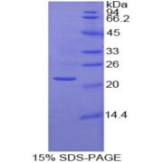 SDS-PAGE analysis of Human MMP1 Protein.