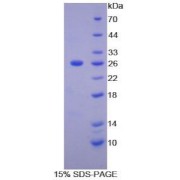 SDS-PAGE analysis of recombinant Human Matrix Metalloproteinase 11 (MMP11) Protein.