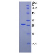 SDS-PAGE analysis of Human Matrix Metalloproteinase 2 (MMP2) Protein.