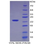 SDS-PAGE analysis of Human Matrix Metalloproteinase 3 (MMP3) Protein.