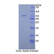 SDS-PAGE analysis of Rat Matrix Metalloproteinase 7 (MMP7) Protein.