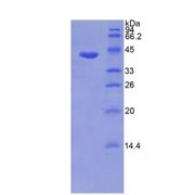 SDS-PAGE analysis of Human Matrix Metalloproteinase 8 (MMP8) Protein.
