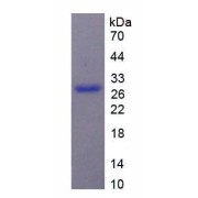 SDS-PAGE analysis of Human MCSP Protein.