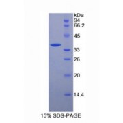 SDS-PAGE analysis of Mouse MCAM Protein.