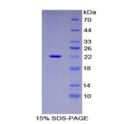 SDS-PAGE analysis of Human MANF Protein.