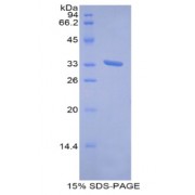SDS-PAGE analysis of recombinant Human Metallothionein 1E Protein.
