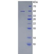 SDS-PAGE analysis of Human MAP2 Protein.